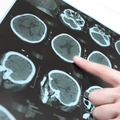 Diagnostico de Distúrbios da Consciência, Memória e do Comportamento